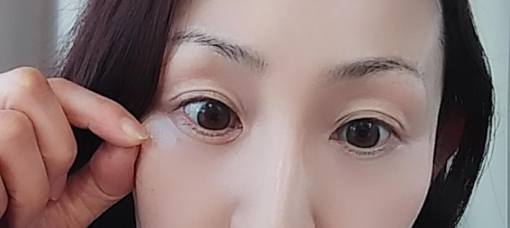 マイクロニードルパッチ